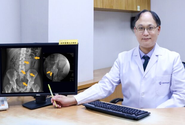 矽膠棒誤插入體內 博愛全台首例內視鏡取出